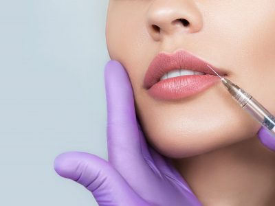 Cropped sensual female lips, procedure lip augmentation. Syringe near womans mouth, injections for increase lips shape